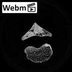 DV15-46 Homo sapiens thoracic vertebra second ct stack movie