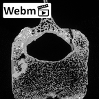 DV15-57 Homo sapiens thoracic vertebra twelfth ct stack movie