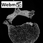 DV15-58 Homo sapiens lumbar vertebra first ct stack movie