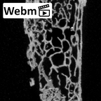 DV15-65 Homo sapiens sternum ct stack movie