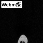 DV15-66 Homo sapiens rib first right ct stack movie