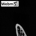 DV15-68 Homo sapiens rib second right ct stack movie