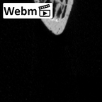 DV15-69 Homo sapiens rib second left ct stack movie