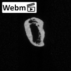 DV15-71 Homo sapiens rib third left ct stack movie