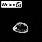 DV15-74 Homo sapiens rib fourth left ct stack movie