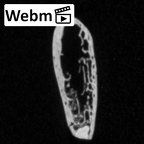 DV15-91 Homo sapiens rib ct stack movie