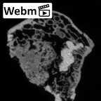 DV16-107 Homo sapiens os coxae left ct stack movie