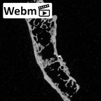 DV16-160 Homo sapiens vertebra ct stack movie
