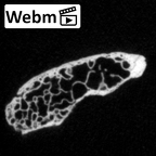 DV16-183 Homo sapiens pelvic fragment ct stack movie