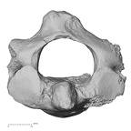 DV16-32 Homo sapiens axis superior