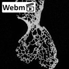 DV16-34 Homo sapiens cervical vertebra fourth ct stack movie
