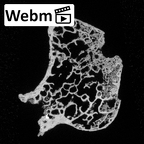 DV16-35 Homo sapiens cervical vertebra fourth ct stack movie