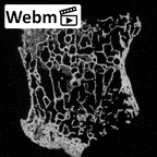 DV16-38 Homo sapiens cervical vertebra sixth ct stack movie