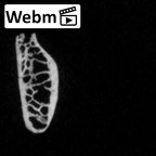 DV16-42 Homo sapiens rib ct stack movie