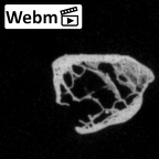 DV16-50 Homo sapiens rib ct stack movie