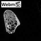 DV16-51 Homo sapiens rib ct stack movie