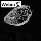 DV16-57 Homo sapiens scapula right ct stack movie