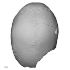 DV11-1 Homo sapiens cranium superior