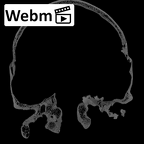 DV13-1 Homo sapiens cranium ct stack movie