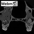 DV13-1 Homo sapiens maxilla ct stack movie