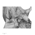 DV13-1 Homo sapiens temporal left inferior