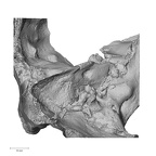 DV13-1 Homo sapiens temporal left posterior