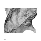 DV13-1 Homo sapiens temporal left superior