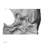 DV13-1 Homo sapiens temporal right inferior