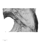 DV13-1 Homo sapiens temporal right superior