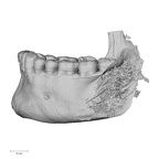 DV13-2 Homo sapiens mandible dentition lateral