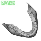 DV13-2 Homo sapiens mandible dentition ply