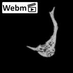 DV14-155 Homo sapiens cranium fragment ct stack movie
