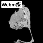 DV14-158 Homo sapiens cranium fragment ct stack movie