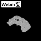 DV14-161 Homo sapiens cranium fragment ct stack movie