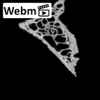 DV14-163 Homo sapiens cranium fragment ct stack movie