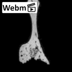DV14-173 Homo sapiens cranium fragment ct stack movie