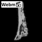 DV14-180c Homo sapiens cranium fragment ct stack movie
