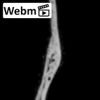 DV14-180i Homo sapiens cranium fragment ct stack movie