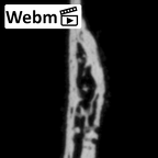 DV14-180k Homo sapiens cranium fragment ct stack movie