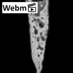 DV14-180p Homo sapiens cranium fragment ct stack movie