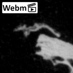 DV14-180y Homo sapiens cranium fragment ct stack movie