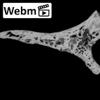 DV14-1 Homo sapiens cranium fragment ct stack movie