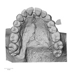 DV14-1 H. sapiens maxilla