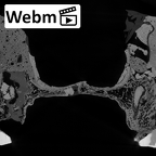 DV14-1 Homo sapiens maxilla ct stack movie