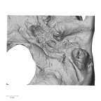 DV14-1 Homo sapiens temporal left inferior