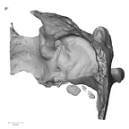 DV14-1 Homo sapiens temporal left posterior