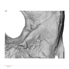 DV14-1 Homo sapiens temporal left superior