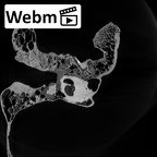 DV14-1 Homo sapiens temporal left ct stack movie