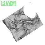 DV14-1 Homo sapiens temporal left ply