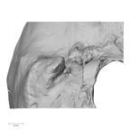 DV14-1 H. sapiens temporal right